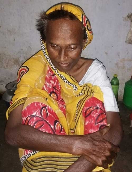 In Assam jail for 4 yrs, Nepalese woman severely ill before her return to home