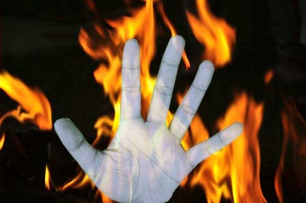 Class 10 student set ablaze by unidentified persons in Andhra